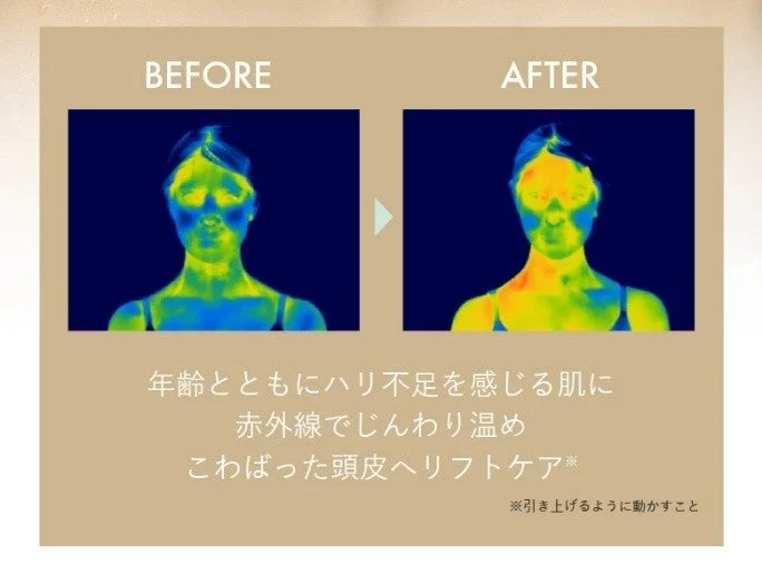 年齢とともにハリ不足を感じる肌とこわばった頭皮に対する赤外線温熱リフトケアのビフォーアフターをサーモグラフィーで比較した画像です。ケアにより肌の温度が上昇している様子が示されています。